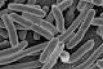 leggi tutto l'articolo Da una tossina dell'intestino la cura per l'Alzheimer - Gaianews.it Da una tossina dell'intestino la cura per l'Alzheimer - Gaianews.it