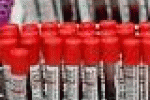 leggi tutto l'articolo Un test del sangue svela il rischio di morte per infarto - La Stampa Un test del sangue svela il rischio di morte per infarto - La Stampa