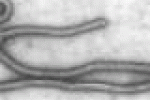 leggi tutto l'articolo Ebola, realizzato un dispositivo per individuare il virus - Rai News Ebola, realizzato un dispositivo per individuare il virus - Rai News
