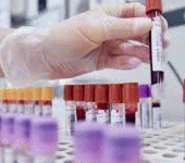 leggi tutto l'articolo Istituto superiore della Sanità: «Meningite da Escherichia Coli: forma rarissima. Ecco quando è consigliato il vaccino» Istituto superiore della Sanità: «Meningite da Escherichia Coli: forma rarissima. Ecco quando è consigliato il vaccino»
