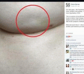 leggi tutto l'articolo Cancro al seno, nel post virale su Facebook
c'è un sintomo sconosciuto ai più | Guarda Cancro al seno, nel post virale su Facebook
c'è un sintomo sconosciuto ai più | Guarda