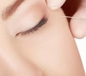 leggi tutto l'articolo Estetica, punture spiana-rughe: 10 regole per il filler sicuro Estetica, punture spiana-rughe: 10 regole per il filler sicuro