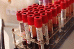 Sangue artificiale da cellule staminali: servirà per le trasfusioni in emergenza