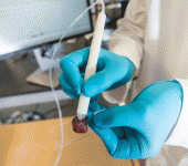 leggi tutto l'articolo Tumori, dieci secondi per diagnosticarli grazie a una penna speciale Tumori, dieci secondi per diagnosticarli grazie a una penna speciale