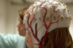 leggi tutto l'articolo Epilessia, come comportarsi se si assiste ad una crisi Epilessia, come comportarsi se si assiste ad una crisi