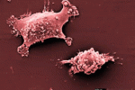 Microvescicole pro-angiogeniche derivate da Staminali del Cordone