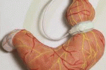 leggi tutto l'articolo BENDAGGIO GASTRICO BENDAGGIO GASTRICO