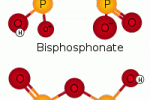Durata del trattamento con bifosfonati