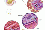 Cellule produttrici di insulina dalle cellule stromali derivati dal cordone ombelicale