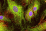 Limoli retinal regeneration technique