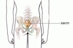 leggi tutto l'articolo Cisti sacro-coccigea: intervento mini-invasivo di Bascom-Gips (o tecnica "Israeliana"). Cisti sacro-coccigea: intervento mini-invasivo di Bascom-Gips (o tecnica "Israeliana").