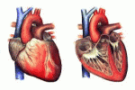 leggi tutto l'articolo Sangue cordonale e staminali derivate: nuove terapie per la cardiomiopatia dilatativa idiopatica? Sangue cordonale e staminali derivate: nuove terapie per la cardiomiopatia dilatativa idiopatica?