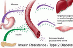 Staminali cordonali migliorano la resistenza all'insulina in modelli di diabete 2