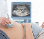Diagnosi prenatale: in cosa consiste la villocentesi?