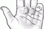 leggi tutto l'articolo Il DITO A SCATTO o TENOVAGINALITE STENOSANTE! Il DITO A SCATTO o TENOVAGINALITE STENOSANTE!