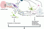 Trapianto di staminali per l'encefalomiopatia neurogastrointestinale mitocondriale