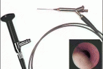leggi tutto l'articolo Endoscopia vie lacrimali Endoscopia vie lacrimali