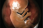 leggi tutto l'articolo Ritardo di crescita fetale Ritardo di crescita fetale