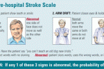 Tempestività nel segnalare uno STROKE