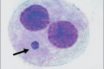 Cellule Staminali Mesenchimali umane per valutare citotossicità e genotossicità di farmaci