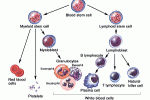 Trapianto di staminali ematopoietiche migliora la prognosi di LAM con mielodisplasia