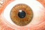 Cellule staminali del cordone e nuove prospettive nella riparazione di danni corneali