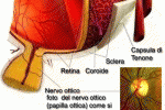 leggi tutto l'articolo Escavazione testa nervo ottico Escavazione testa nervo ottico