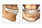 Occlusione e Prevenzione