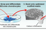 Rigenerazione di osso e cartilagine utilizzando cellule staminali mesenchimali del cordone