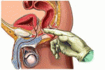 Quadro seminale nelle patologie flogistiche 