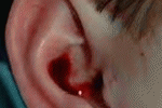 Comportamento in caso di otorragia (fuoriuscita di sangue dalle orecchie)