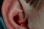 leggi tutto l'articolo Comportamento in caso di otorragia (fuoriuscita di sangue dalle orecchie) Comportamento in caso di otorragia (fuoriuscita di sangue dalle orecchie)