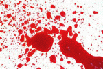 leggi tutto l'articolo Emorragia o forte perdita di sangue Emorragia o forte perdita di sangue