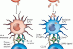 Analisi di trapiati di staminali ematopoietiche non manipolate in adulti con leucemia acuta