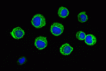leggi tutto l'articolo Secondo trapianto allogenico di staminali ematopoietiche in bambini con grave anemia aplastica Secondo trapianto allogenico di staminali ematopoietiche in bambini con grave anemia aplastica