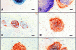 Differenziazione in megacariociti a partire da cellule staminali embrionali umane