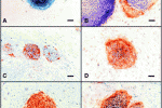 Studio della senescenza delle cellule Staminali Mesenchimali in coltura