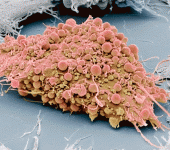 leggi tutto l'articolo Staminali mesenchimali di origine diversa: compate proliferazione, lunghezza telomeri e pluripotenza Staminali mesenchimali di origine diversa: compate proliferazione, lunghezza telomeri e pluripotenza