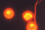 leggi tutto l'articolo L’etichettatura con DTPA e PKH26 influenza le caratteristiche delle staminali? L’etichettatura con DTPA e PKH26 influenza le caratteristiche delle staminali?