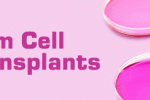 L'uso del trapianto di cellule staminali allogeniche moderata-grave tromboastenia Glanzmann