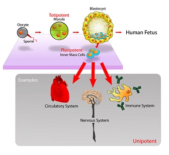 trombocitopenia-immune