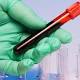 L'80% degli italiani dona sangue con costanza - Corriere della Sera