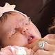 Bimba nasce con due denti davanti, evento molto raro - Il Messaggero