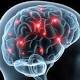 Risonanza al cervello può individuare problemi mentali - Altopascio.info