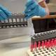 Meningite a 5 anni, scatta - Corriere della Sera