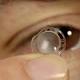 Staminali per riparare la cornea: italiano il primo farmaco al mondo - La Repubblica