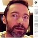 Hugh Jackman, appello su Instagram dopo il 5° intervento per tumore al naso: «Usate le creme solari» - Corriere della Sera