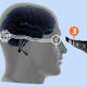 Creato occhio bionico che comunica senza fili con il cervello: test ... - TGCOM