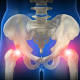 Dal gomito anti rigetto all'osso autoriparante , il futuro della medicina è in 3D - Intelligonews