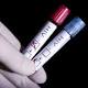 Diffusi per errore test Hiv di 800 pazienti londinesi - Centro Meteo Italiano